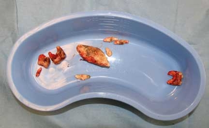 Extraction is a last resort. Sometimes, teeth cannot be saved. Wild Animal Sanctuary black bear dental treatment