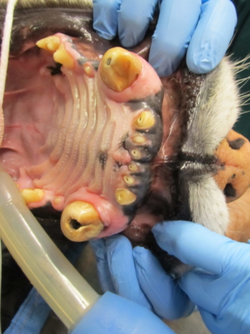 TItan's fractures upper canine teeth requiring root canal therapy.